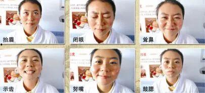 面瘫艾灸视频,轻松缓解面部不适，恢复微笑